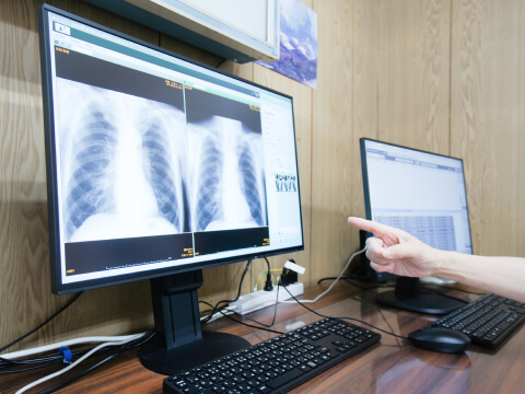 胸部X線検査